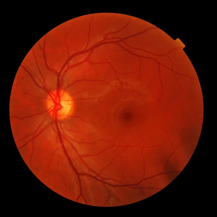 Imagery of a retina scan