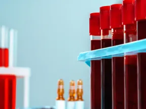 Image from 1977 of blood in vials